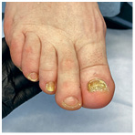 Иллюстрация к книге — Подология понятно. Важен каждый шаг. Справочник по проблемам подологии для клиентов и мастеров эстетики [i_135.jpg]