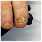 Иллюстрация к книге — Подология понятно. Важен каждый шаг. Справочник по проблемам подологии для клиентов и мастеров эстетики [i_136.jpg]