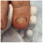 Иллюстрация к книге — Подология понятно. Важен каждый шаг. Справочник по проблемам подологии для клиентов и мастеров эстетики [i_138.jpg]