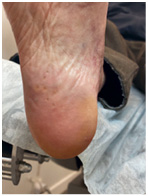 Иллюстрация к книге — Подология понятно. Важен каждый шаг. Справочник по проблемам подологии для клиентов и мастеров эстетики [i_141.jpg]