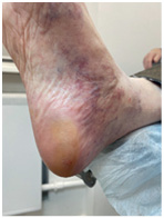 Иллюстрация к книге — Подология понятно. Важен каждый шаг. Справочник по проблемам подологии для клиентов и мастеров эстетики [i_142.jpg]