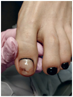 Иллюстрация к книге — Подология понятно. Важен каждый шаг. Справочник по проблемам подологии для клиентов и мастеров эстетики [i_144.jpg]