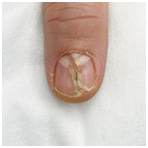 Иллюстрация к книге — Подология понятно. Важен каждый шаг. Справочник по проблемам подологии для клиентов и мастеров эстетики [i_146.jpg]