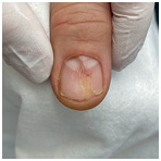 Иллюстрация к книге — Подология понятно. Важен каждый шаг. Справочник по проблемам подологии для клиентов и мастеров эстетики [i_147.jpg]