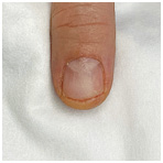 Иллюстрация к книге — Подология понятно. Важен каждый шаг. Справочник по проблемам подологии для клиентов и мастеров эстетики [i_148.jpg]