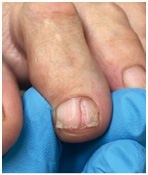 Иллюстрация к книге — Подология понятно. Важен каждый шаг. Справочник по проблемам подологии для клиентов и мастеров эстетики [i_149.jpg]