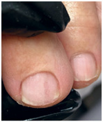 Иллюстрация к книге — Подология понятно. Важен каждый шаг. Справочник по проблемам подологии для клиентов и мастеров эстетики [i_151.jpg]