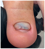 Иллюстрация к книге — Подология понятно. Важен каждый шаг. Справочник по проблемам подологии для клиентов и мастеров эстетики [i_152.jpg]