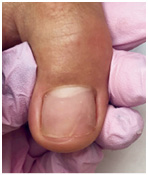 Иллюстрация к книге — Подология понятно. Важен каждый шаг. Справочник по проблемам подологии для клиентов и мастеров эстетики [i_155.jpg]