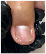 Иллюстрация к книге — Подология понятно. Важен каждый шаг. Справочник по проблемам подологии для клиентов и мастеров эстетики [i_159.jpg]