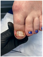 Иллюстрация к книге — Подология понятно. Важен каждый шаг. Справочник по проблемам подологии для клиентов и мастеров эстетики [i_163.jpg]