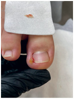 Иллюстрация к книге — Подология понятно. Важен каждый шаг. Справочник по проблемам подологии для клиентов и мастеров эстетики [i_169.jpg]