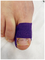 Иллюстрация к книге — Подология понятно. Важен каждый шаг. Справочник по проблемам подологии для клиентов и мастеров эстетики [i_170.jpg]