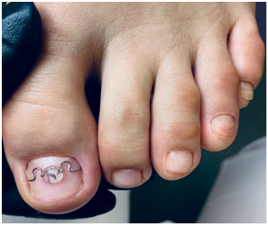 Иллюстрация к книге — Подология понятно. Важен каждый шаг. Справочник по проблемам подологии для клиентов и мастеров эстетики [i_172.jpg]