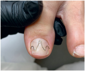 Иллюстрация к книге — Подология понятно. Важен каждый шаг. Справочник по проблемам подологии для клиентов и мастеров эстетики [i_174.jpg]