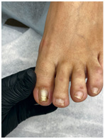 Иллюстрация к книге — Подология понятно. Важен каждый шаг. Справочник по проблемам подологии для клиентов и мастеров эстетики [i_179.jpg]