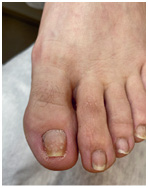 Иллюстрация к книге — Подология понятно. Важен каждый шаг. Справочник по проблемам подологии для клиентов и мастеров эстетики [i_186.jpg]