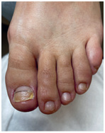 Иллюстрация к книге — Подология понятно. Важен каждый шаг. Справочник по проблемам подологии для клиентов и мастеров эстетики [i_187.jpg]