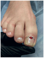 Иллюстрация к книге — Подология понятно. Важен каждый шаг. Справочник по проблемам подологии для клиентов и мастеров эстетики [i_188.jpg]