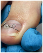 Иллюстрация к книге — Подология понятно. Важен каждый шаг. Справочник по проблемам подологии для клиентов и мастеров эстетики [i_191.jpg]