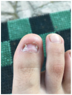 Иллюстрация к книге — Подология понятно. Важен каждый шаг. Справочник по проблемам подологии для клиентов и мастеров эстетики [i_201.jpg]