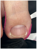 Иллюстрация к книге — Подология понятно. Важен каждый шаг. Справочник по проблемам подологии для клиентов и мастеров эстетики [i_219.jpg]