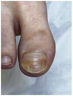 Иллюстрация к книге — Подология понятно. Важен каждый шаг. Справочник по проблемам подологии для клиентов и мастеров эстетики [i_223.jpg]