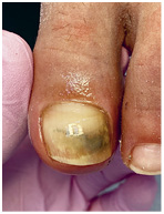 Иллюстрация к книге — Подология понятно. Важен каждый шаг. Справочник по проблемам подологии для клиентов и мастеров эстетики [i_227.jpg]