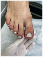 Иллюстрация к книге — Подология понятно. Важен каждый шаг. Справочник по проблемам подологии для клиентов и мастеров эстетики [i_230.jpg]