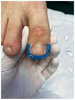 Иллюстрация к книге — Подология понятно. Важен каждый шаг. Справочник по проблемам подологии для клиентов и мастеров эстетики [i_233.jpg]