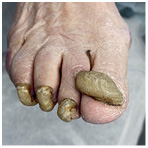 Иллюстрация к книге — Подология понятно. Важен каждый шаг. Справочник по проблемам подологии для клиентов и мастеров эстетики [i_248.jpg]