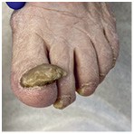 Иллюстрация к книге — Подология понятно. Важен каждый шаг. Справочник по проблемам подологии для клиентов и мастеров эстетики [i_249.jpg]