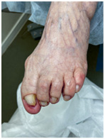 Иллюстрация к книге — Подология понятно. Важен каждый шаг. Справочник по проблемам подологии для клиентов и мастеров эстетики [i_255.jpg]