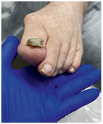 Иллюстрация к книге — Подология понятно. Важен каждый шаг. Справочник по проблемам подологии для клиентов и мастеров эстетики [i_257.jpg]