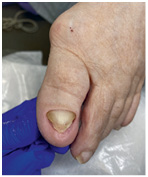 Иллюстрация к книге — Подология понятно. Важен каждый шаг. Справочник по проблемам подологии для клиентов и мастеров эстетики [i_258.jpg]