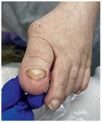 Иллюстрация к книге — Подология понятно. Важен каждый шаг. Справочник по проблемам подологии для клиентов и мастеров эстетики [i_259.jpg]