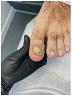 Иллюстрация к книге — Подология понятно. Важен каждый шаг. Справочник по проблемам подологии для клиентов и мастеров эстетики [i_260.jpg]