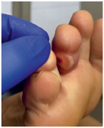 Иллюстрация к книге — Подология понятно. Важен каждый шаг. Справочник по проблемам подологии для клиентов и мастеров эстетики [i_277.jpg]