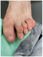 Иллюстрация к книге — Подология понятно. Важен каждый шаг. Справочник по проблемам подологии для клиентов и мастеров эстетики [i_280.jpg]