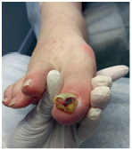 Иллюстрация к книге — Подология понятно. Важен каждый шаг. Справочник по проблемам подологии для клиентов и мастеров эстетики [i_285.jpg]