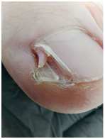 Иллюстрация к книге — Подология понятно. Важен каждый шаг. Справочник по проблемам подологии для клиентов и мастеров эстетики [i_288.jpg]