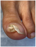 Иллюстрация к книге — Подология понятно. Важен каждый шаг. Справочник по проблемам подологии для клиентов и мастеров эстетики [i_291.jpg]