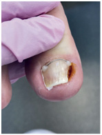 Иллюстрация к книге — Подология понятно. Важен каждый шаг. Справочник по проблемам подологии для клиентов и мастеров эстетики [i_293.jpg]