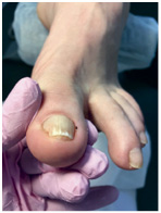 Иллюстрация к книге — Подология понятно. Важен каждый шаг. Справочник по проблемам подологии для клиентов и мастеров эстетики [i_294.jpg]