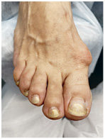 Иллюстрация к книге — Подология понятно. Важен каждый шаг. Справочник по проблемам подологии для клиентов и мастеров эстетики [i_301.jpg]