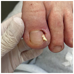 Иллюстрация к книге — Подология понятно. Важен каждый шаг. Справочник по проблемам подологии для клиентов и мастеров эстетики [i_331.jpg]