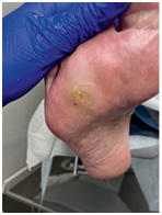 Иллюстрация к книге — Подология понятно. Важен каждый шаг. Справочник по проблемам подологии для клиентов и мастеров эстетики [i_340.jpg]