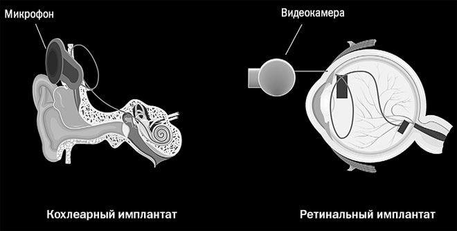 Иллюстрация к книге — Живой мозг. Удивительные факты о нейропластичности и возможностях мозга [img_10.jpg]