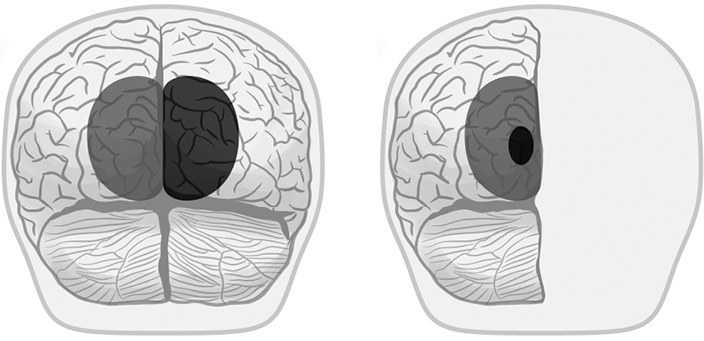 Иллюстрация к книге — Живой мозг. Удивительные факты о нейропластичности и возможностях мозга [img_50.jpg]