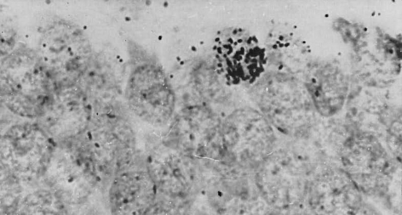 Иллюстрация к книге — Революция в голове. Как новые нервные клетки омолаживают мозг [i_030.jpg]